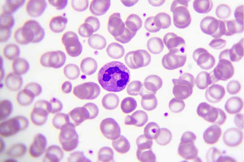 Single neutrophil cell stained pink and purple. Photograph by jarun011 Canva. Used with permission.