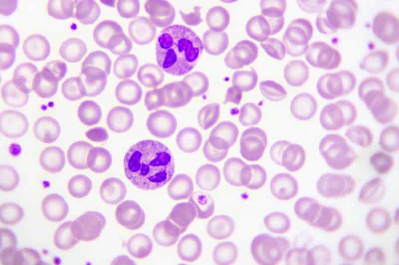 Neutrophil cells two stained purple. Photograph courtesy of Jarun011 Canva. Used with permission.